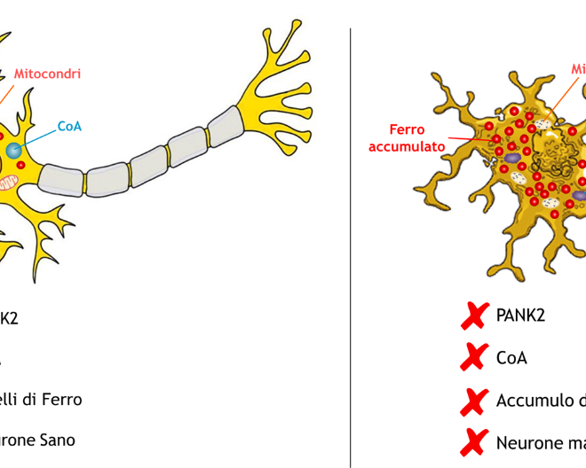 Malattie da accumulo di ferro cerebrale: un coenzima per “correggere” i neuroni malati