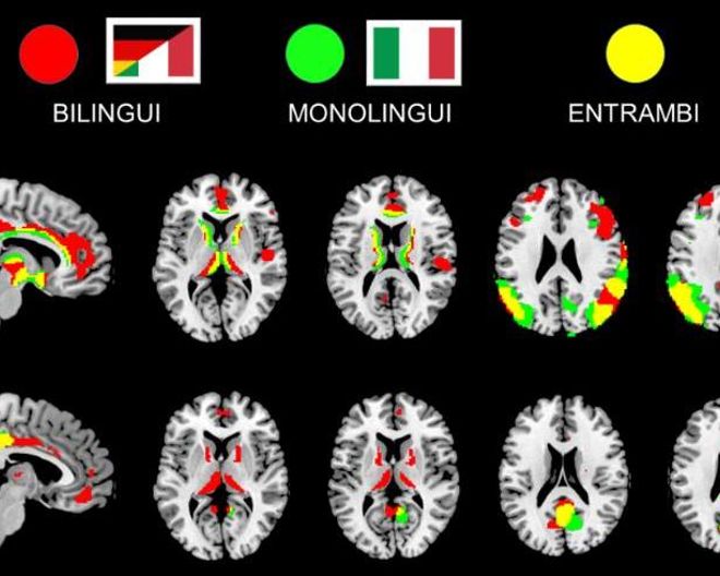 Parlare due lingue ritarda l’insorgenza dell’Alzheimer: intervista alla Prof.ssa Perani