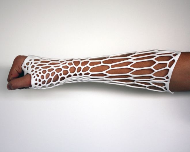 Cortex: l'esoscheletro 3D che potrebbe sostituire il gesso