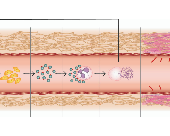 Sclerodermia: al San Raffaele identificata molecola chiave nello sviluppo della malattia