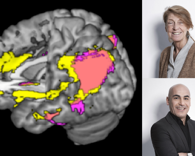 Parlare due lingue aiuta a proteggere dall’alzheimer: i proff. Perani e Abutalebi tra gli autori dello studio.