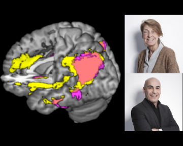 Parlare due lingue aiuta a proteggere dall’alzheimer: i proff. Perani e Abutalebi tra gli autori dello studio.