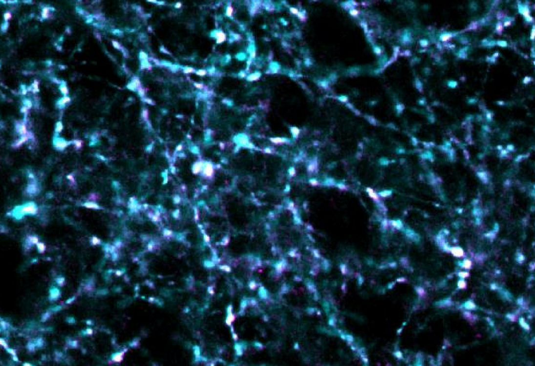 Unisr Research Develops A Revolutionary Method To Detect Real Time Synapse Activity Universita Vita Salute San Raffaele