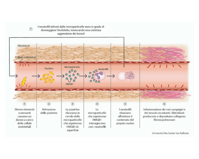 Sclerodermia: al San Raffaele identificata molecola chiave nello sviluppo della malattia