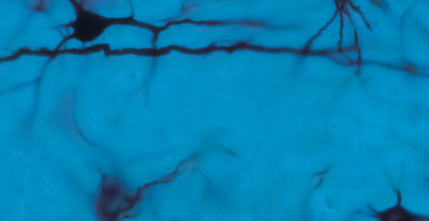 Un viaggio nel futuro delle neuroscienze