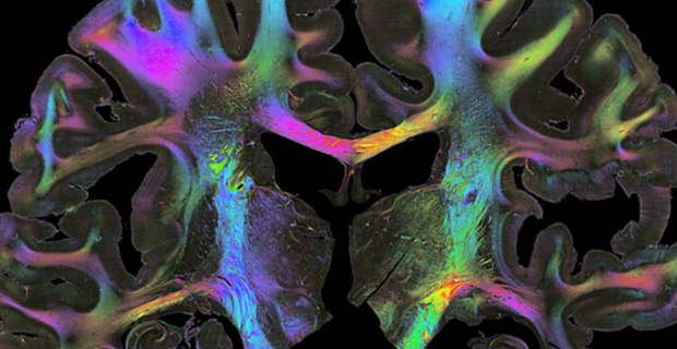 “Human Brains”: al via la seconda fase del progetto di Fondazione Prada