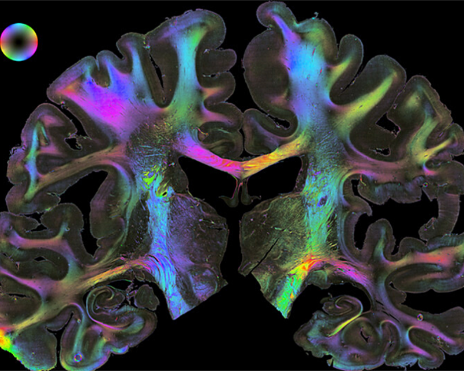 “Human Brains”, il progetto di Fondazione Prada dedicato agli studi del cervello