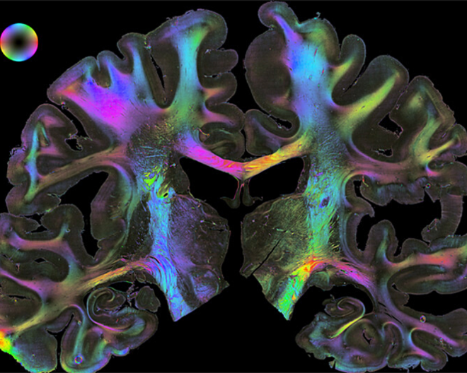 “Human Brains”: al via la seconda fase del progetto di Fondazione Prada