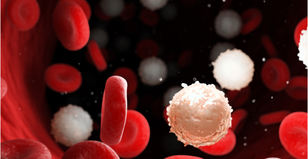 Leucemia linfoblastica acuta: dal San Raffaele due risultati potrebbero favorirne prognosi e terapia