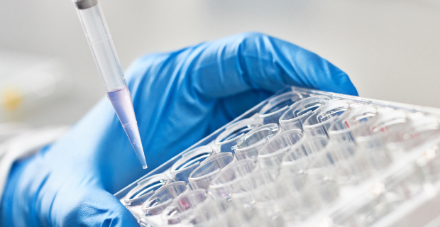 Acute myeloid leukemia: cells causing relapse identified at San Raffaele