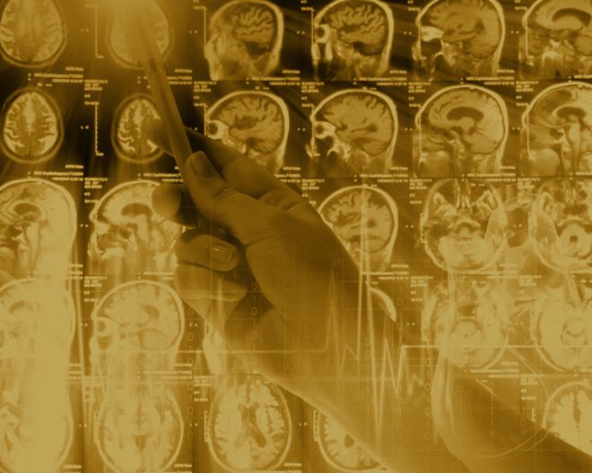22nd Advanced Course on Magnetic Resonance Imaging in Multiple Sclerosis.