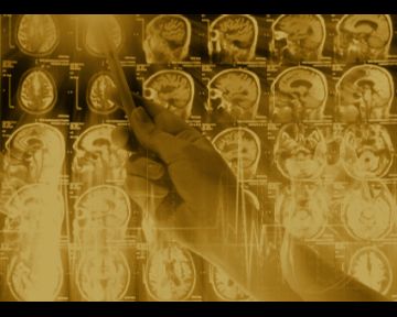 22nd Advanced Course on Magnetic Resonance Imaging in Multiple Sclerosis.