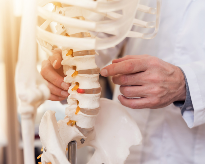 Le fratture vertebrali sono altamente frequenti nei pazienti Covid-19
