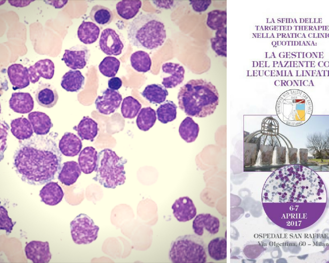 Corso  “La sfida delle Targeted Therapies nella pratica clinica quotidiana: la gestione del paziente con leucemia linfatica cronica”